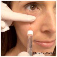 Botox And Restylane Work In Different Ways