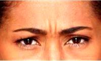 27 Year Old Woman Treated With Botox By Doctor Dennis Gross, MD, New York Dermatologist