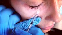 Botox Injection Under Eye