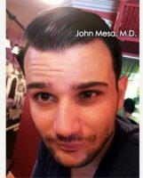Doctor John Mesa, MD, New York Plastic Surgeon - 31 Year Old Man Treated With Botox Injections For Asymmetric Forehead Wrinkles