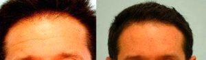 Doctor Sam Lam, MD, FACS, Dallas Facial Plastic Surgeon - Botox