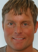 Dr Paul Vitenas, Jr., MD, Houston Plastic Surgeon - Botox