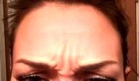 Injections Relax Certain Muscles In The Face