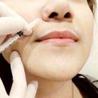 Legally Administer Botox In The United States