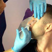 Medical Insurance Does Not Cover Botox Treatments