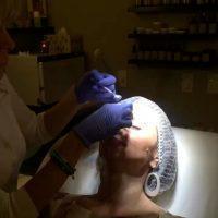 Botox Dosing Is Measured In Biological Units