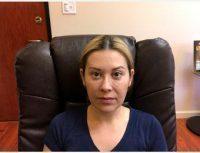 Botox Injection With Doctor Faraz Valaie, MD, Newport Beach Physician