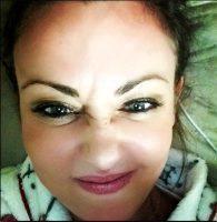 Botox Injections And Bunny Lines