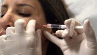 Botox Pricing By Cc Is Uncommon
