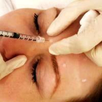 Can Botox Help Frown Lines