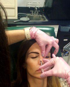 Treating Bunny Lines With Botox Cosmetics