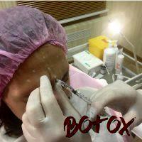 When Should You Start Botox