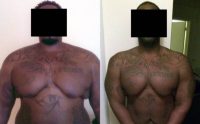 25-34 year old woman treated with Weight Loss